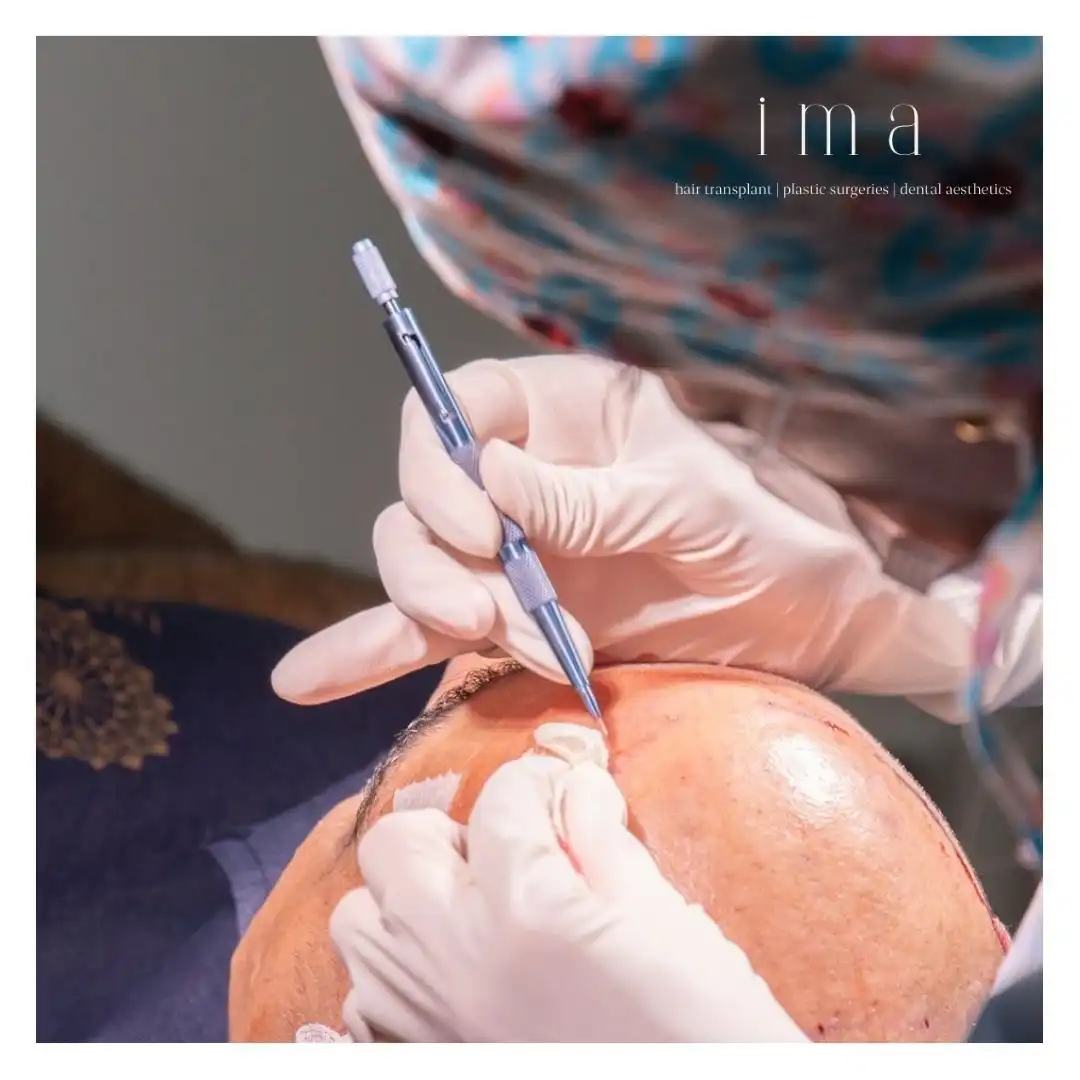 FUE mi DHI mi Daha İyi? Detaylı Karşılaştırma