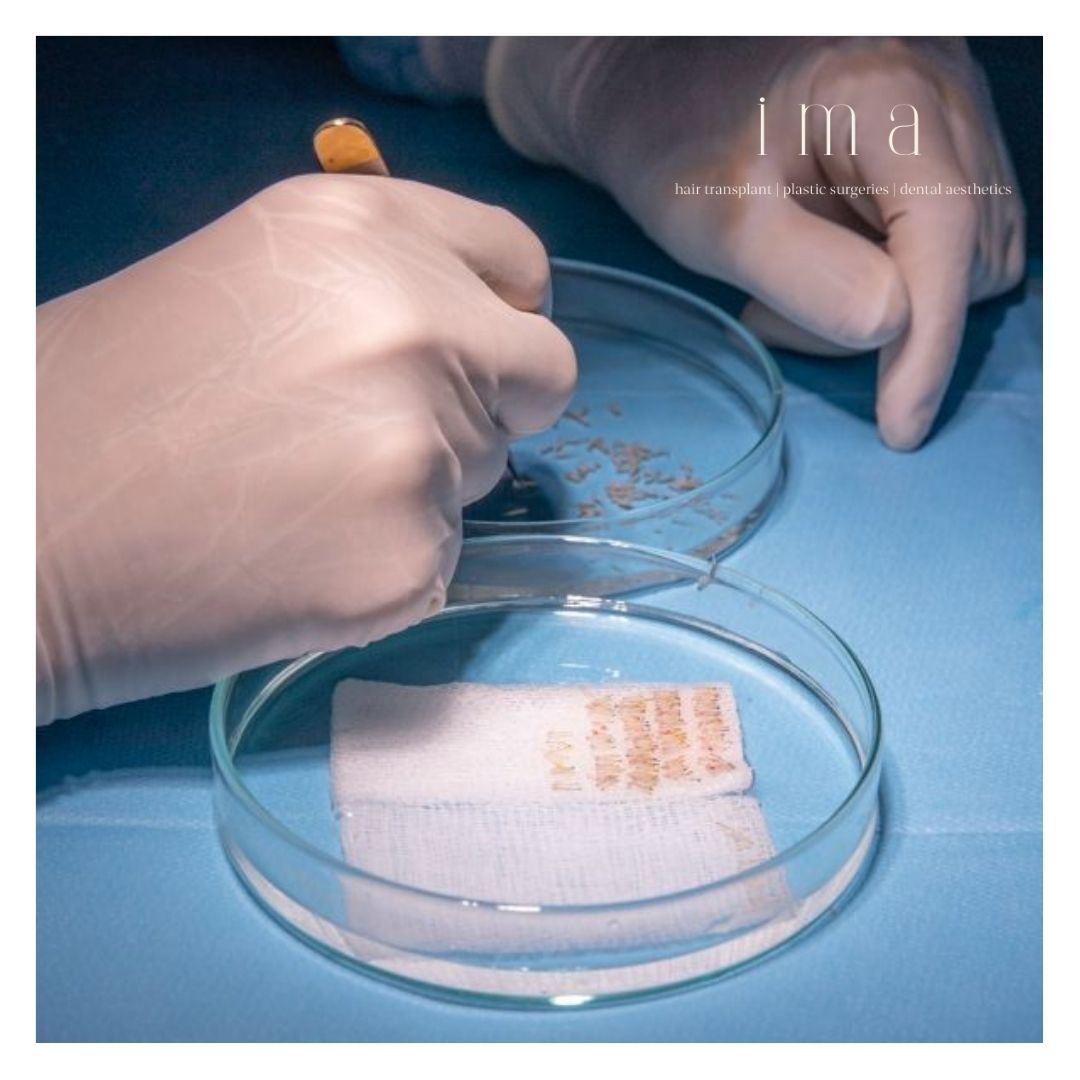 Saç Ekimi Sonrası Kaşıntı: Nedenleri ve Çözümleri