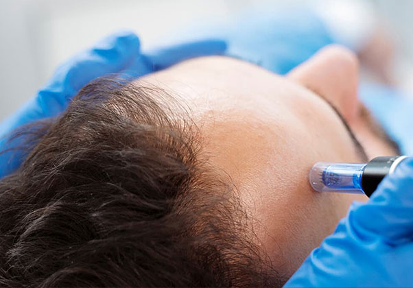 Tıraşsız Saç Ekimi