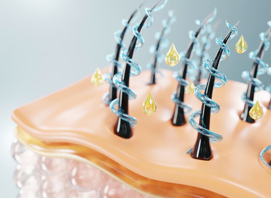 Saç Ekimi Sonrası Kızarıklık Ne Kadar Sürer?